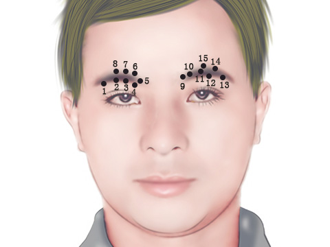 灵犀眉毛有痣课堂眉毛痣的位置与命运图解