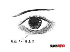 灵犀眼睛课堂:眼眶发黑代表什么