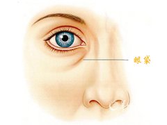 灵犀眼睛课堂:眼袋深的女人面相