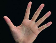 灵犀掌纹图解课堂:手掌颜色与健康
