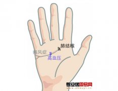 灵犀感情线课堂:手相感情线看你的健康状况