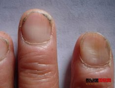 灵犀手指算命课堂:由指甲看你的健康状况