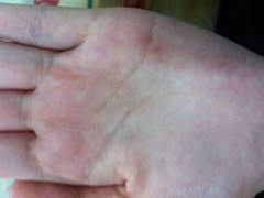 灵犀生命线课堂:手相没有生命线代表什么