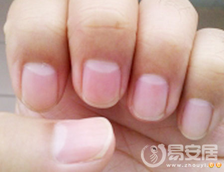 从指甲月牙看你的健康状况
