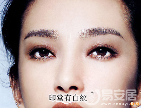 印堂有白纹