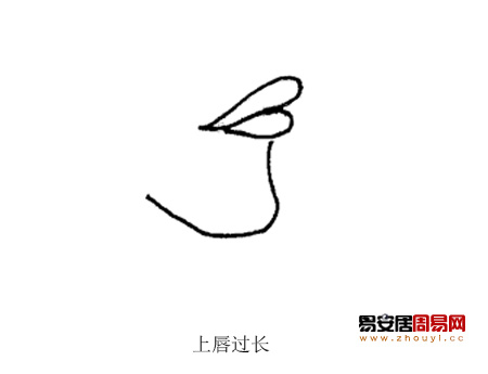 上唇过长
