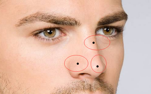 男人鼻子上有痣代表什么，一起来看看