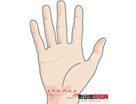 手腕线在手腕动脉处纹路成交叉状